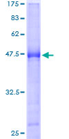 BTG4 Protein - 12.5% SDS-PAGE of human BTG4 stained with Coomassie Blue
