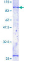 BTK Protein - 12.5% SDS-PAGE of human BTK stained with Coomassie Blue