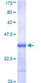 BTK Protein - 12.5% SDS-PAGE Stained with Coomassie Blue.
