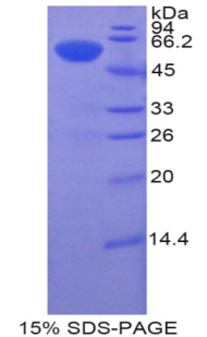 BTK Protein - Recombinant Bruton'S Tyrosine Kinase By SDS-PAGE