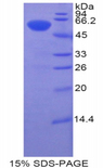 BTK Protein - Recombinant Bruton'S Tyrosine Kinase By SDS-PAGE