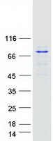 BTK Protein - Purified recombinant protein BTK was analyzed by SDS-PAGE gel and Coomassie Blue Staining