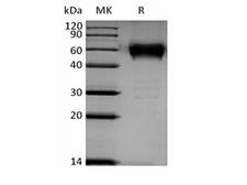 BTLA / CD272 Protein - Recombinant Human B- and T-Lymphocyte Attenuator/BTLA/CD272 (C-mFc)
