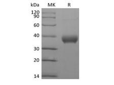 BTN1A1 Protein - Recombinant Human Butyrophilin Subfamily 1 Member A1/BTN1A1 (C-6His-Avi) Biotinylated