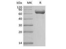 BTN1A1 Protein - Recombinant Human Butyrophilin Subfamily 1 Member A1/BTN1A1 (C-Fc)