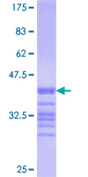 BTN1A1 Protein - 12.5% SDS-PAGE Stained with Coomassie Blue.