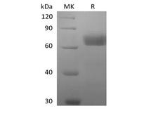BTN2A2 Protein - Recombinant Human Butyrophilin Subfamily 2 Member A2/BTN2A2 (C-Fc-Avi) Biotinylated