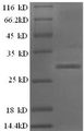 BTN3A1 / CD277 Protein - (Tris-Glycine gel) Discontinuous SDS-PAGE (reduced) with 5% enrichment gel and 15% separation gel.