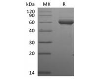 BTN3A1 / CD277 Protein - Recombinant Human Butyrophilin Subfamily 3 Member A1/BTN3A1 (C-Fc-Avi) Biotinylated