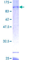 BTN3A3 Protein - 12.5% SDS-PAGE of human BTN3A3 stained with Coomassie Blue