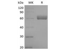 BTNL9 Protein - Recombinant Human Butyrophilin-like Protein 9/BTNL9 (C-Fc)