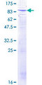 BTRCP / BETA-TRCP Protein - 12.5% SDS-PAGE of human BTRC stained with Coomassie Blue