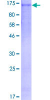 BUB1 Protein - 12.5% SDS-PAGE of human BUB1 stained with Coomassie Blue