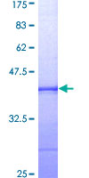 BUB1 Protein - 12.5% SDS-PAGE Stained with Coomassie Blue.