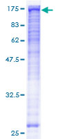 BUB1B / BubR1 Protein - 12.5% SDS-PAGE of human BUB1B stained with Coomassie Blue