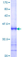 BUB1B / BubR1 Protein - 12.5% SDS-PAGE Stained with Coomassie Blue.