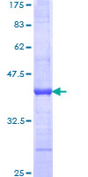 BUD31 Protein - 12.5% SDS-PAGE Stained with Coomassie Blue.