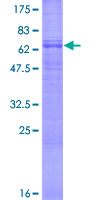 BVES Protein - 12.5% SDS-PAGE of human BVES stained with Coomassie Blue