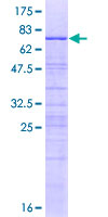 BXDC5 / RPF1 Protein - 12.5% SDS-PAGE of human BXDC5 stained with Coomassie Blue