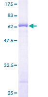 BYSL Protein - 12.5% SDS-PAGE of human BYSL stained with Coomassie Blue