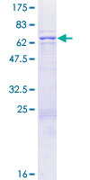 BZW1 / BZAP45 Protein - 12.5% SDS-PAGE of human BZW1 stained with Coomassie Blue