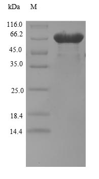 BZW2 Protein - (Tris-Glycine gel) Discontinuous SDS-PAGE (reduced) with 5% enrichment gel and 15% separation gel.