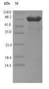 BZW2 Protein - (Tris-Glycine gel) Discontinuous SDS-PAGE (reduced) with 5% enrichment gel and 15% separation gel.