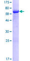 BZW2 Protein - 12.5% SDS-PAGE of human BZW2 stained with Coomassie Blue