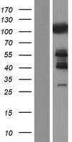 c-CBL Protein - Western validation with an anti-DDK antibody * L: Control HEK293 lysate R: Over-expression lysate