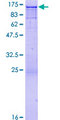 c-CBL Protein - 12.5% SDS-PAGE of human CBL stained with Coomassie Blue