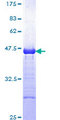 c-CBL Protein - 12.5% SDS-PAGE Stained with Coomassie Blue.