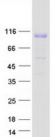 c-CBL Protein - Purified recombinant protein CBL was analyzed by SDS-PAGE gel and Coomassie Blue Staining