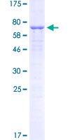 C/EBP Alpha / CEBPA Protein - 12.5% SDS-PAGE of human CEBPA stained with Coomassie Blue