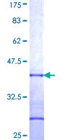 C/EBP Beta / CEBPB Protein - 12.5% SDS-PAGE Stained with Coomassie Blue.
