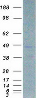 C/EBP Beta / CEBPB Protein - Purified recombinant protein CEBPB was analyzed by SDS-PAGE gel and Coomassie Blue Staining