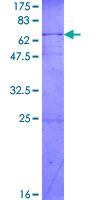C/EBP Epsilon / CEBPE Protein - 12.5% SDS-PAGE of human CEBPE stained with Coomassie Blue