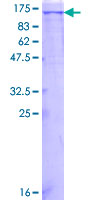 c-Kit / CD117 Protein - 12.5% SDS-PAGE of human KIT stained with Coomassie Blue