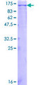 c-Kit / CD117 Protein - 12.5% SDS-PAGE of human KIT stained with Coomassie Blue