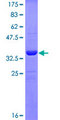 c-Kit / CD117 Protein - 12.5% SDS-PAGE Stained with Coomassie Blue.