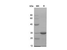 c-Kit / CD117 Protein - Recombinant Human KIT/SCFR Protein (His Tag)-Elabscience
