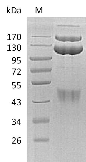 c-Met Protein - (Tris-Glycine gel) Discontinuous SDS-PAGE (reduced) with 5% enrichment gel and 15% separation gel.