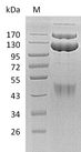 c-Met Protein - (Tris-Glycine gel) Discontinuous SDS-PAGE (reduced) with 5% enrichment gel and 15% separation gel.