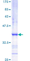 c-Met Protein - 12.5% SDS-PAGE Stained with Coomassie Blue.