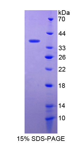 c-Met Protein - Recombinant  Hepatocyte Growth Factor Receptor By SDS-PAGE