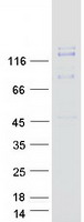 c-Met Protein - Purified recombinant protein MET was analyzed by SDS-PAGE gel and Coomassie Blue Staining