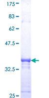 c-Src Kinase / CSK Protein - 12.5% SDS-PAGE Stained with Coomassie Blue.