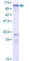 C-TAK1 / MARK3 Protein - 12.5% SDS-PAGE of human MARK3 stained with Coomassie Blue