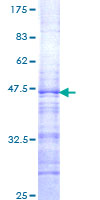 C-TAK1 / MARK3 Protein - 12.5% SDS-PAGE Stained with Coomassie Blue.
