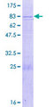 C10orf2 / PEO1 Protein - 12.5% SDS-PAGE of human PEO1 stained with Coomassie Blue