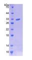 C10orf2 / PEO1 Protein - Recombinant  Twinkle Protein, Mitochondrial By SDS-PAGE